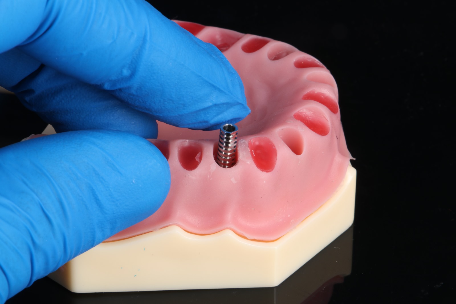 NEP Product Image 10